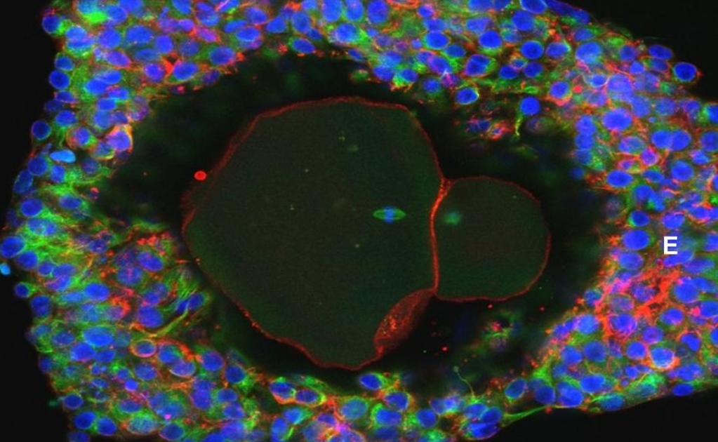 Científicos desarrollan óvulos humanos en laboratorio por primera vez