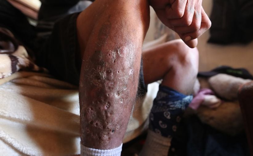 Este es un vistazo más cercano