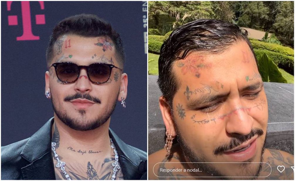 Los tatuajes de Christian Nodal en el rostro hace unos meses y ahora, en pleno proceso para borrarlos. Foto: Clasos/Captura.
