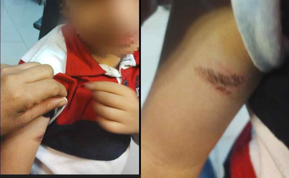 Padres que agredieron a maestra muestran presunta quemadura de su niño Foto: Especial/El Universal