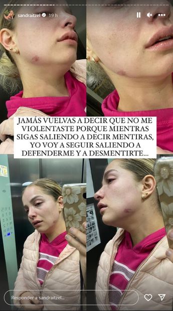 Sandra Itzel compartió en sus redes sociales pruebas de que su ex, Adrián Di Monte, sí la maltrató, luego de que él lo negara.
<p>Foto: Instagram