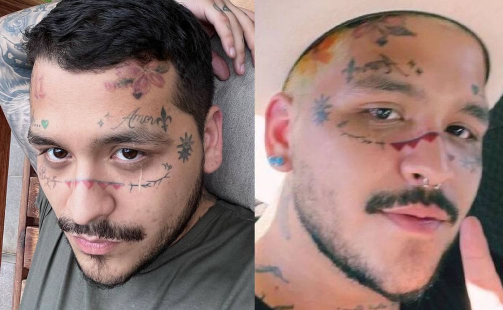 El cantante ha compartido los primeros resultados de las sesiones a las que se ha sometido para eliminar los tatuajes de su rostro. Foto: Instagram