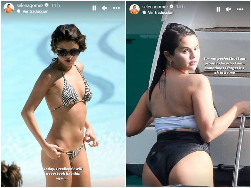 Selena Gomez compara su cuerpo en estas dos fotografías.