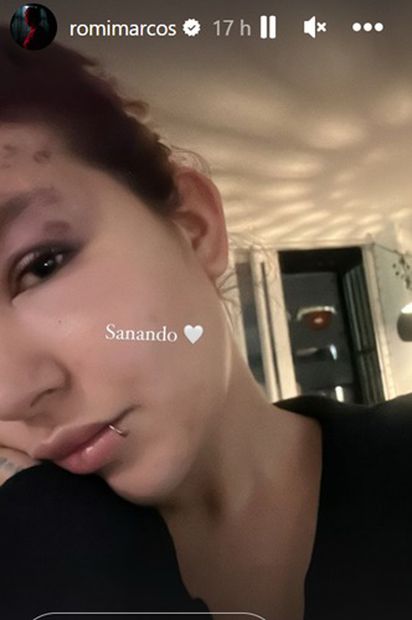 En sus redes sociales, la actriz y cantante ha compartido cómo ha sido su proceso de sanación. Foto: Instagram