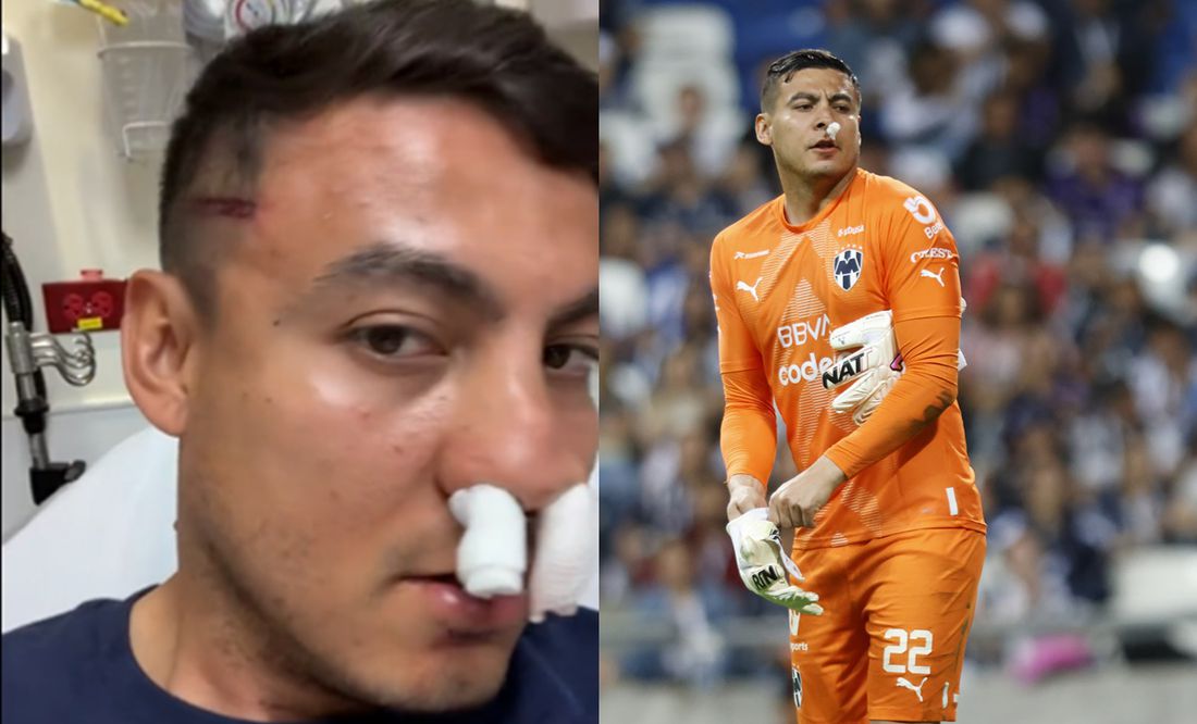 Portero de Rayados muestra sus heridas tras sufrir fractura en el partido contra Santos Laguna