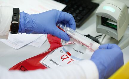 Jalisco reporta segunda muerte por coronavirus o Covid-19