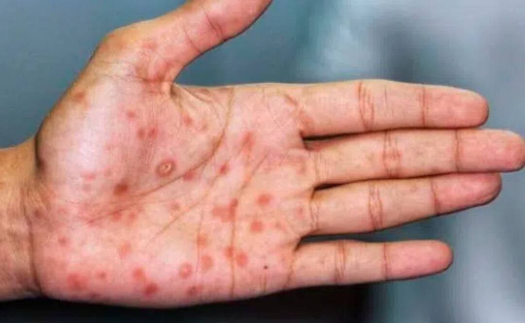 Foto: EFE/El Universal/ 