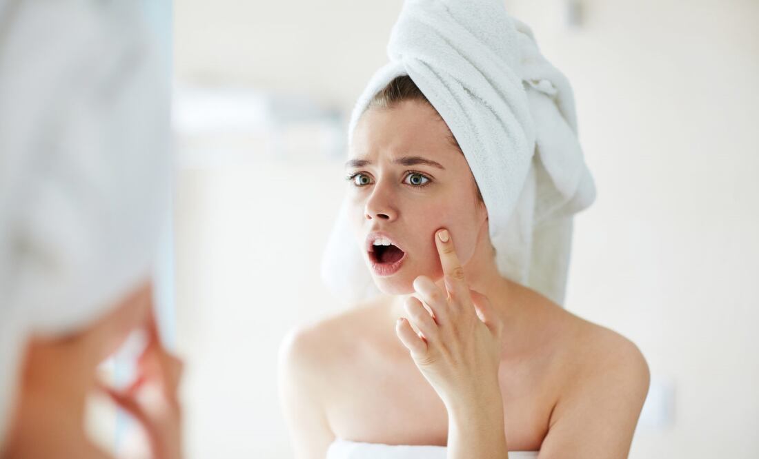 En tu botiquín y tu refrigerador encontrarás remedios para combatir un granito inesperado. Foto: Istockphoto