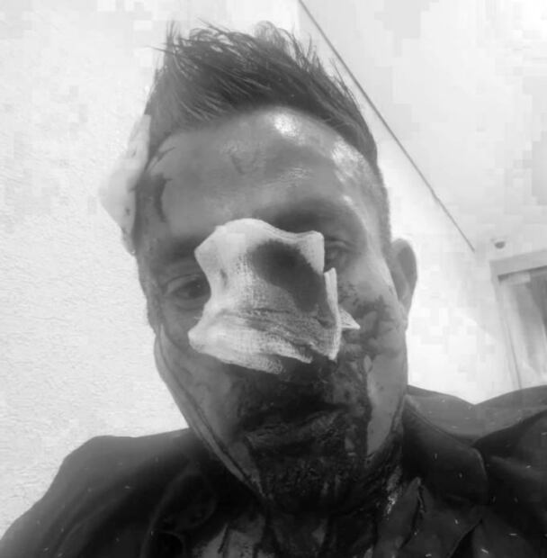 Atacan con piedras y palas a jóvenes de la comunidad LGBT afuera de Rico Club en la Zona Rosa