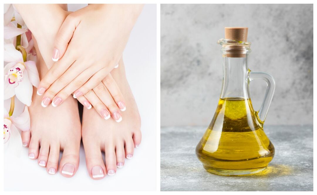 Conoce cómo cuidar las uñas con vinagre aplicando este truco rápido y fácll. Imagen: Freepik