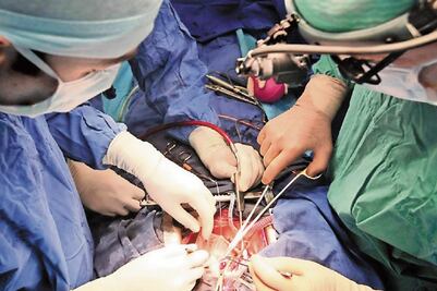 Ensayan técnica para detectar daño cerebral por anestesias