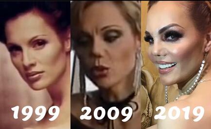 La nariz de Carmen Campuzano no tiene arreglo