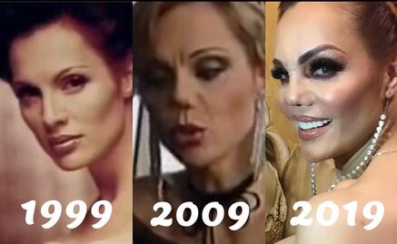 La nariz de Carmen Campuzano no tiene arreglo