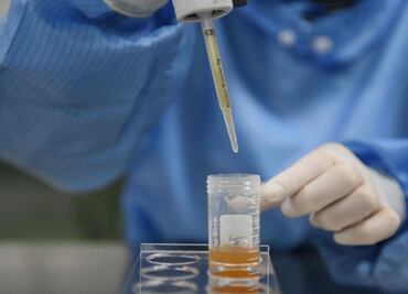 Mexican scientists develop COVID-19 antibody test