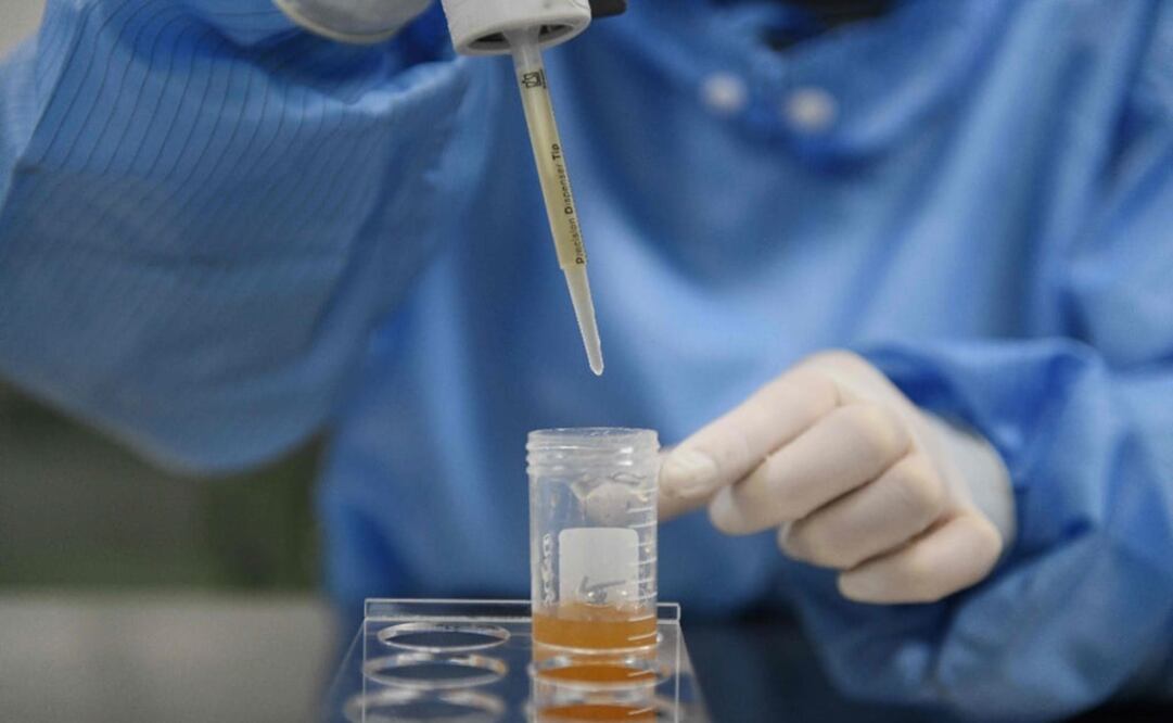 A technician working with a medical kit at a lab - Photo: Greg Baker/AFP