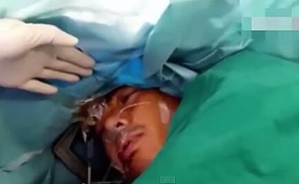 Video. Paciente despierta en plena operación cerebral