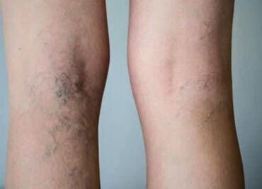 Descubre el secreto de las piernas impecables con estas vitaminas