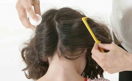 Científicos en EU dicen que piojos son más resistentes