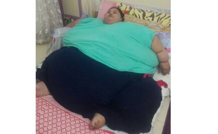 Mujer egipcia de 500 kilos será operada en la India para salvar su vida