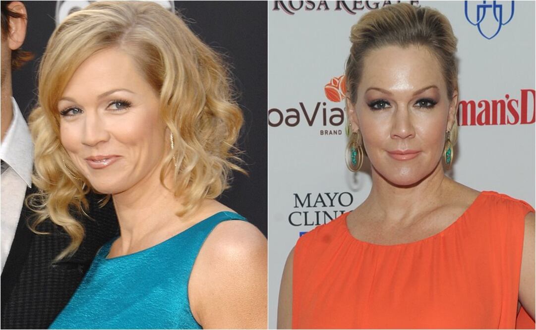 Actriz de "Beverly Hills" impacta con su aspecto