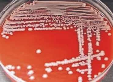 Lanzan alerta por bacteria intestinal Klebsiella oxytoca