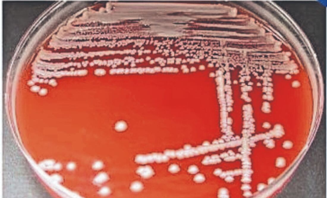La bacteria, con forma de bastón, “se encuentra comúnmente en el tracto gastrointestinal de humanos y animales, así como en el medio ambiente”. Foto Especial