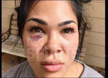 Peladora de UFC recibe golpiza de su esposo