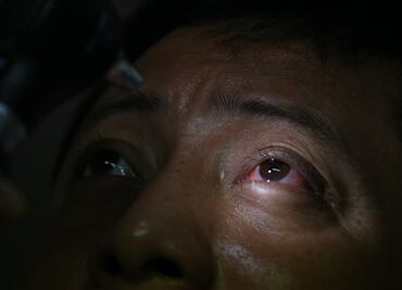 ¡A cuidarse los ojos!