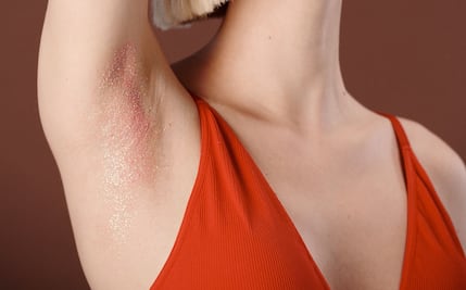 Cómo aliviar las axilas irritadas con estos 5 remedios caseros