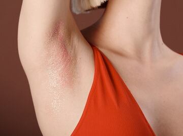 Cómo aliviar las axilas irritadas con estos 5 remedios caseros