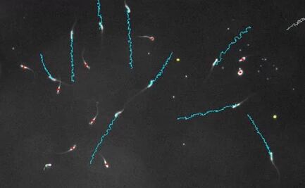 Espermatozoides "envenenan" a sus competidores en carrera al óvulo