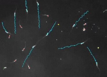 Espermatozoides "envenenan" a sus competidores en carrera al óvulo