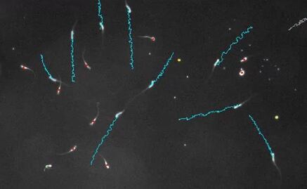 Espermatozoides "envenenan" a sus competidores en carrera al óvulo