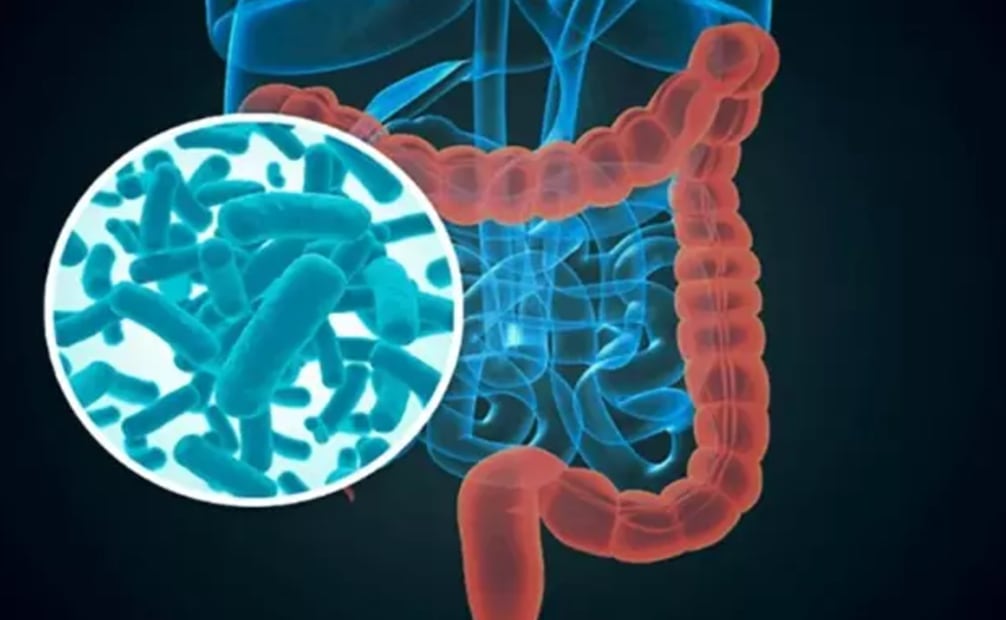 La ciclosporiasis es una enfermedad intestinal provocada por el parásito microscópico Cyclospora cayetanensis. Imagen: Ilustrativa / Archivo