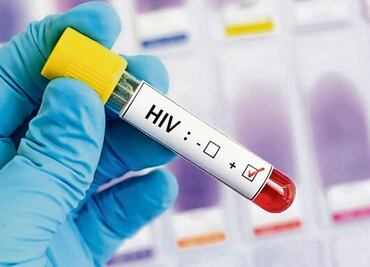 ¿Qué hay con "Mosaico", el ensayo clínico que promete una vacuna eficaz contra el VIH?