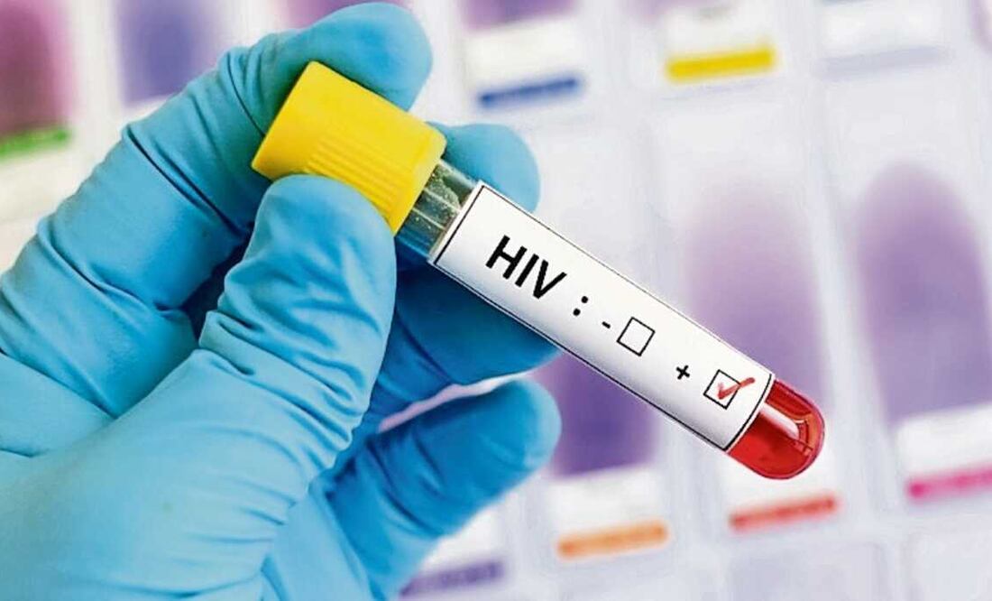 Son tres vacunas que se están por desarrollar: Ad26, gp140 mosaico y vacuna gc140. Foto: El Universal, archivo