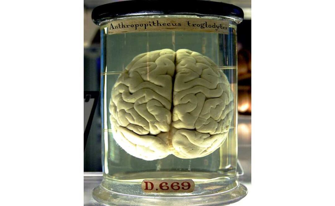 La sonda utilizará nanoestructuras para canalizar las señales del tejido cerebral. Foto: Especial