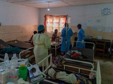 Viruela del mono: OMS recomienda mascarillas solo para personal sanitario y cuidadores de enfermos de mpox