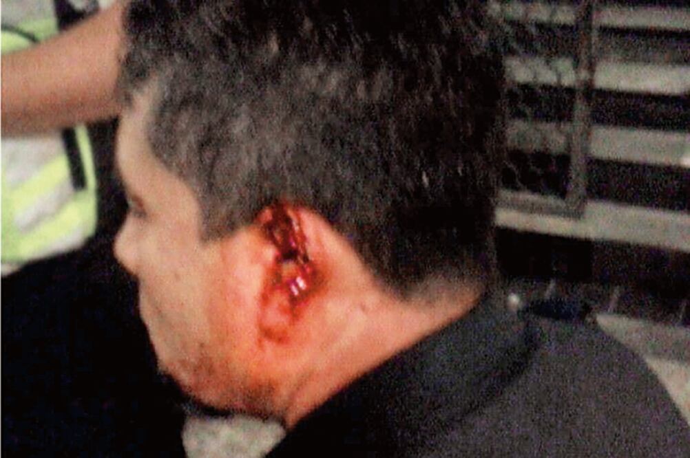 El agente fue trasladado al hospital Álvaro Obregón para ser atendido (ESPECIAL)