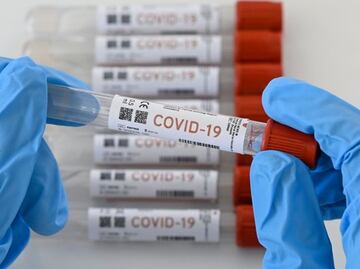 Reportan primer caso sospechoso de ómicron en Yucatán