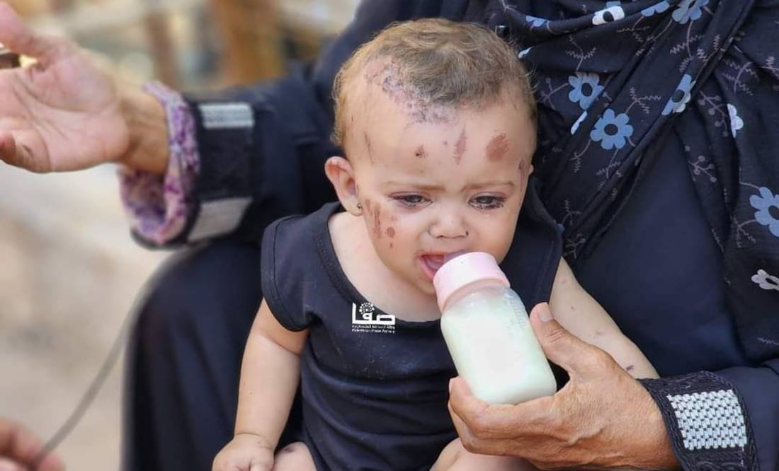 Envuelta en un vestido negro, con el rostro lleno de heridas, la niña causó una gran conmoción en el patio del hospital Naser, lugar de encuentro de familias que buscan a sus allegados desaparecidos o vienen a depositar heridos. Foto: X @QudsNen
