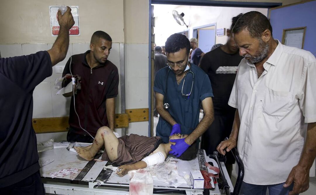 Un niño palestino herido en un bombardeo israelí sobre la Franja de Gaza es atendido en un hospital en Jan Yunis. FOTO: AP Foto/Jehad Alshrafi)