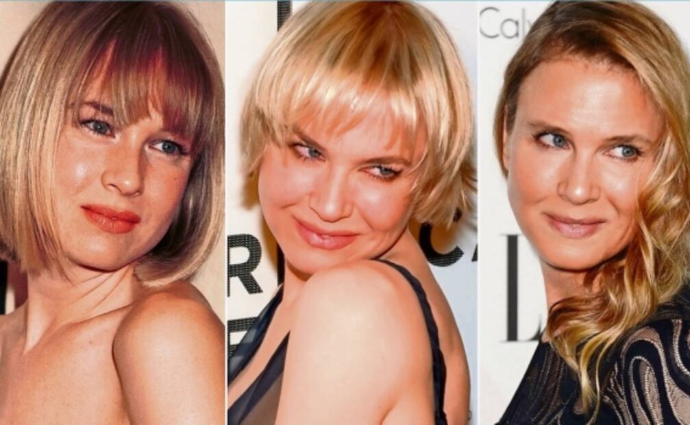 Los rostros de Lis Vega, ​​​​​​​Reneé Zellweger y Nicole Kidman quedaron ¡irreconocibles!