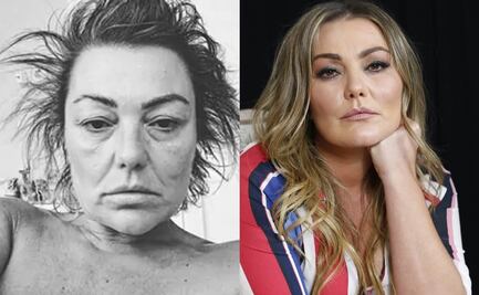 Estos serían los motivos que llevaron a la exvocalista de la Oreja de Van Gogh a internarse en una clínica de rehabilitación