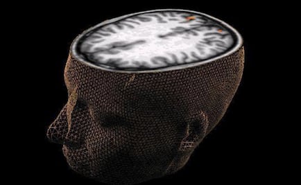 ¿Cómo afecta al cerebro la bipolaridad?