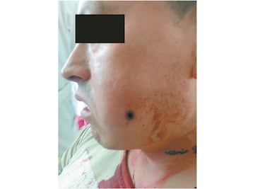 Balean a reo en Reclusorio Oriente