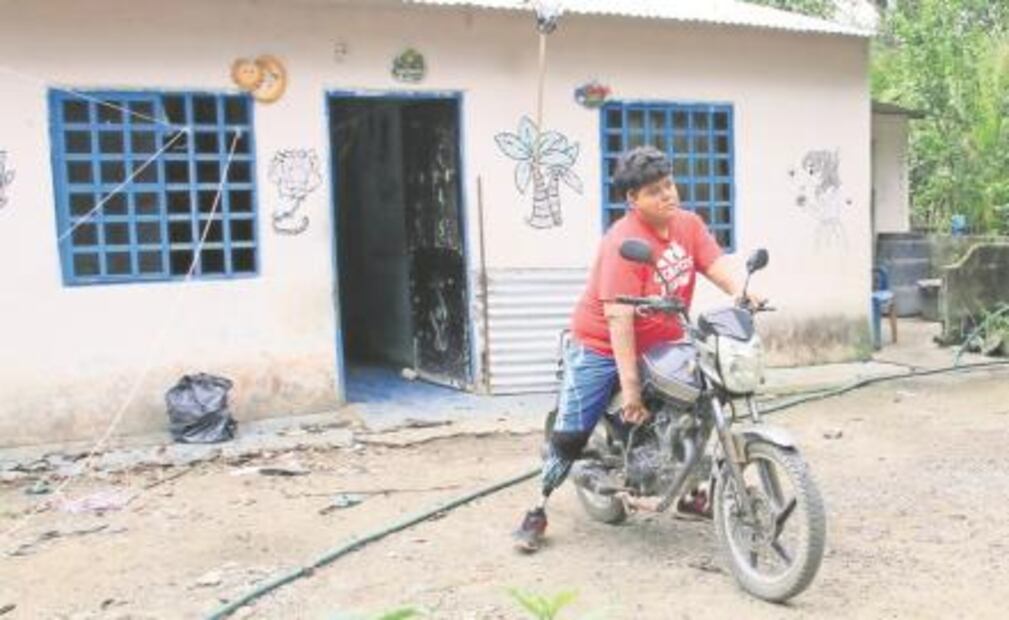 Perdió sus piernas por el huachicol; “no vale la pena arriesgarse”