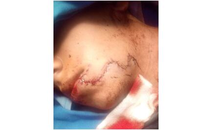 Paga reparación del daño marine que hirió a menor