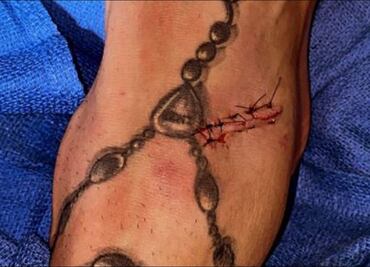 Alan Pulido muestra la brutal cortada que le dejó el pisotón de un rival