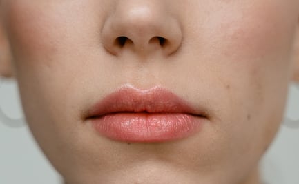 Soluciones para decir adiós a los labios agrietados